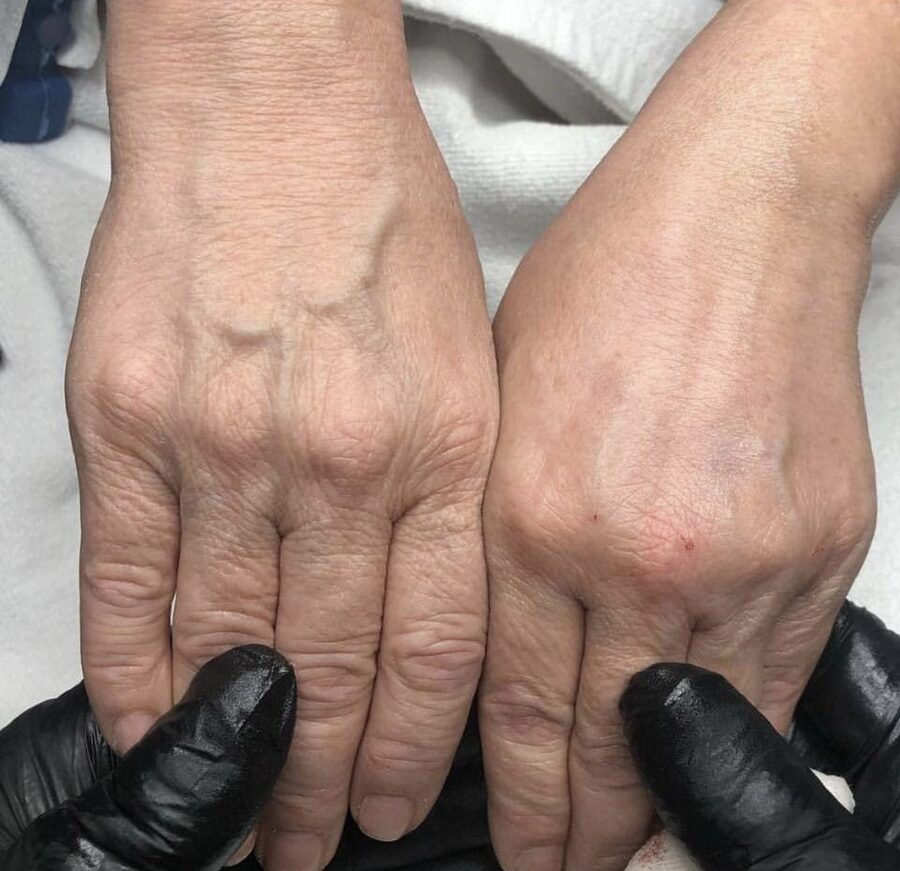 Hands &mdash; before and after