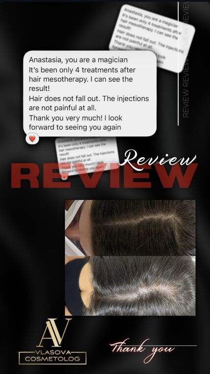 Client review for Hair mesotherapy
