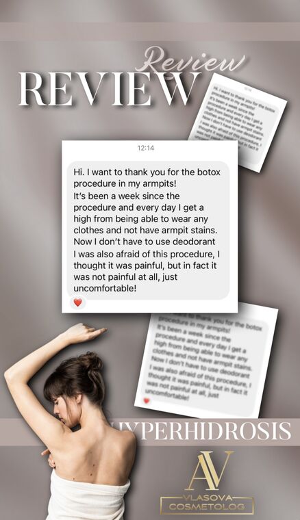 Client review for Hyperhidrosis treatment